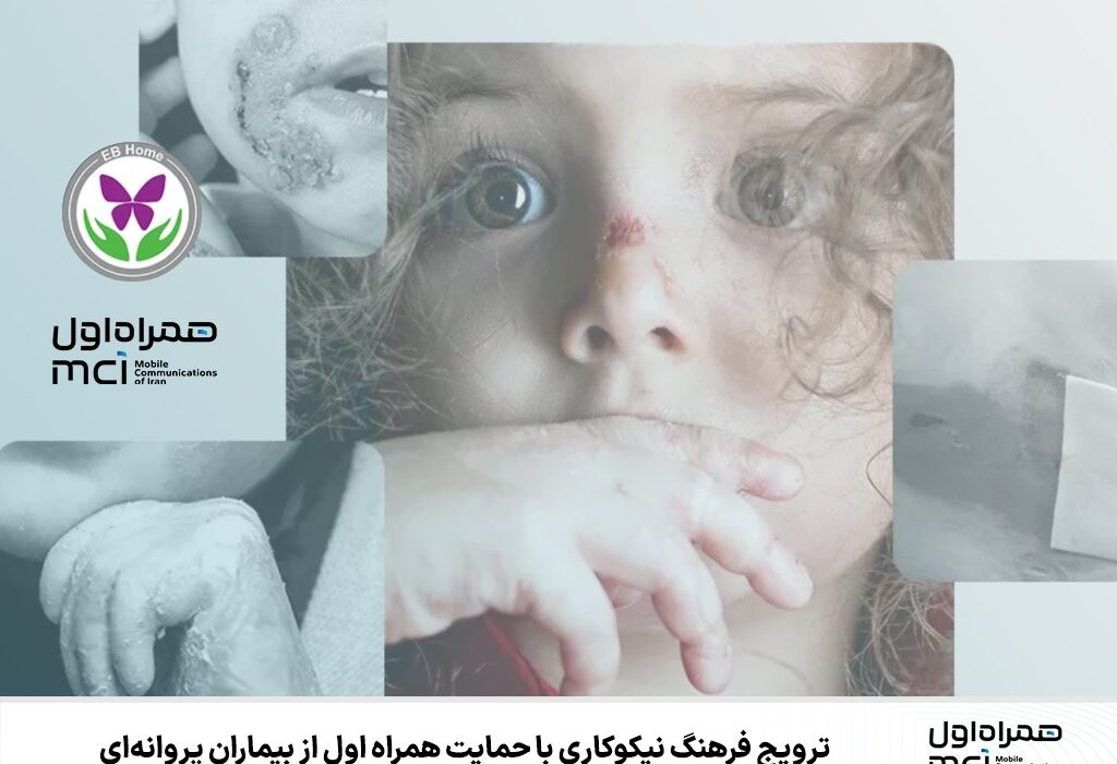 ترویج فرهنگ نیکوکاری با حمایت همراه اول از بیماران پروانه‌ای